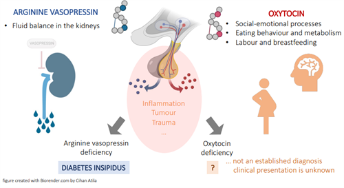 Oxytocin - the forgotten pituitary hormone? - Pituitary Foundation